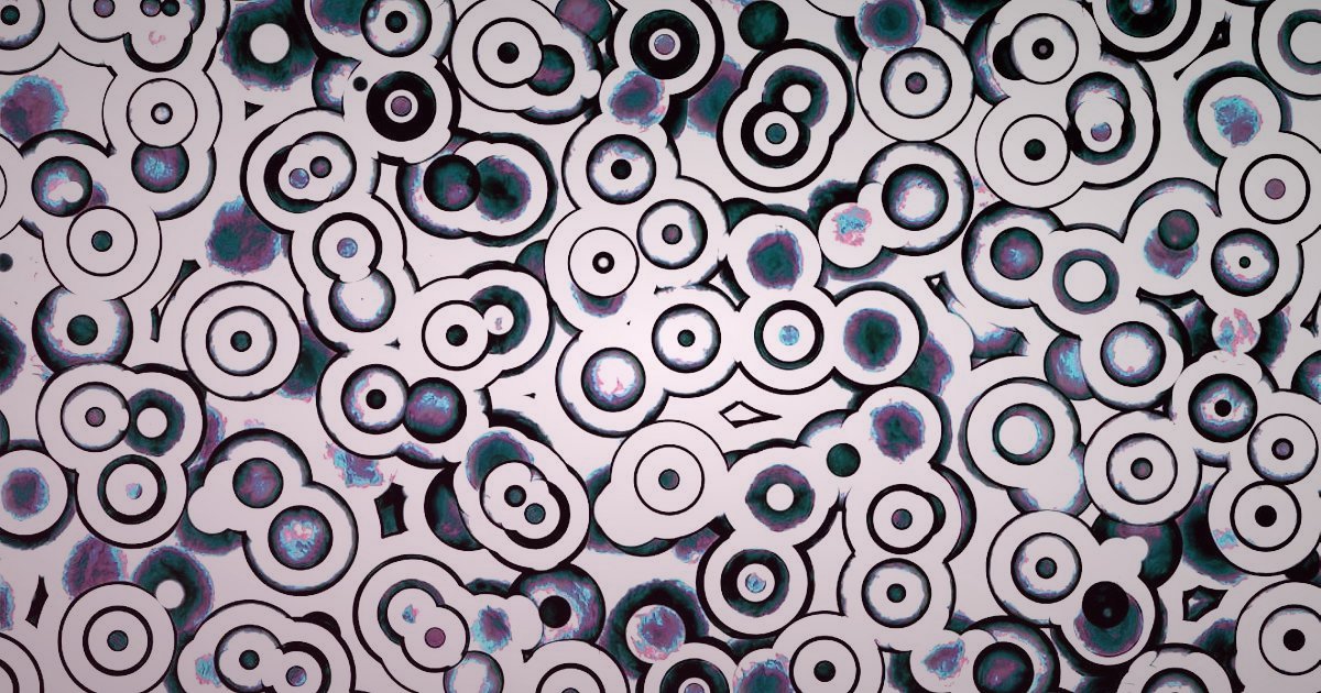 Dropshipping.gen.tr Avantajları: Stoksuz Satışta 2026'da Nasıl Başarılı Olunur? - question marks arranged in a circular pattern