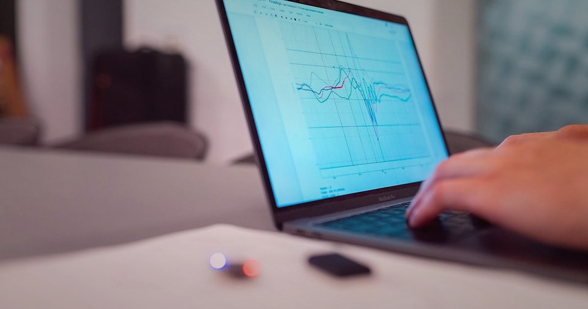 XML Bayilik Nedir? 2026'da Dropshipping'te Başarıya Ulaşmanın Sırları - person typing laptop financial charts screen